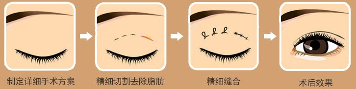 https://img.miyanlife.com/mnt/Editor/2019-02-12/5c6274f47c1ff.jpg