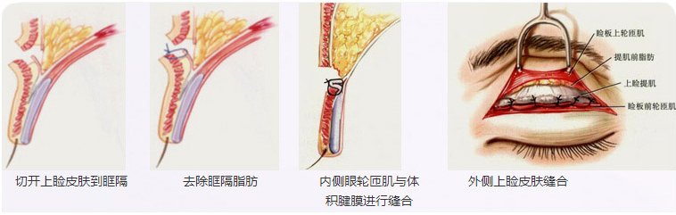 https://img.miyanlife.com/mnt/Editor/2019-02-12/5c62750570836.jpg