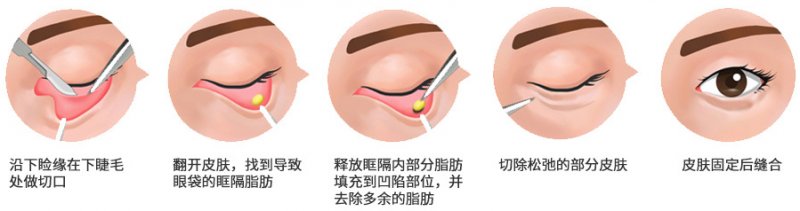 https://img.miyanlife.com/mnt/Editor/2019-02-12/5c6277e8cc609.jpg