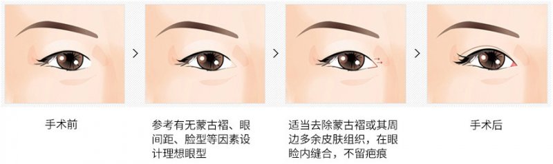 https://img.miyanlife.com/mnt/Editor/2019-02-12/5c627ea6a52c5.jpg
