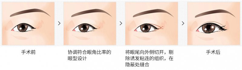 https://img.miyanlife.com/mnt/Editor/2019-02-12/5c627ecbc1774.jpg