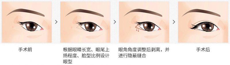 https://img.miyanlife.com/mnt/Editor/2019-02-12/5c627edaa9370.jpg