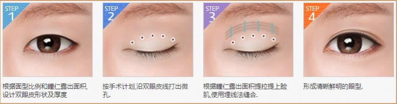 https://img.miyanlife.com/mnt/Editor/2019-02-12/5c6285e0726b9.jpg