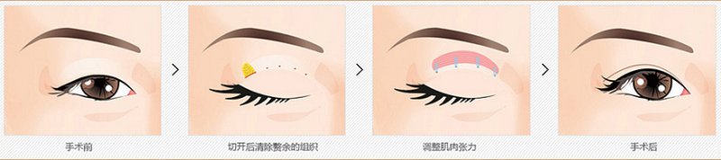 https://img.miyanlife.com/mnt/Editor/2019-02-12/5c6285eb2c60e.jpg