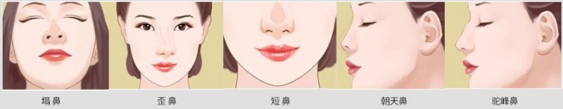 https://img.miyanlife.com/mnt/Editor/2019-02-12/5c628d9194f4f.jpg