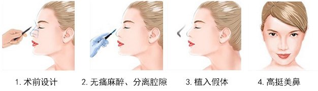 https://img.miyanlife.com/mnt/Editor/2019-02-12/5c628d9ecb02e.jpg