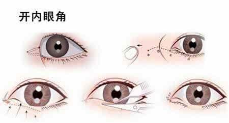 https://img.miyanlife.com/mnt/Editor/2019-08-14/5d53cc2b04d19.jpg