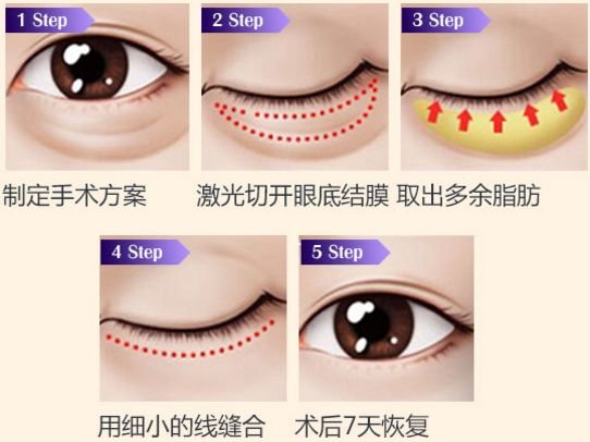 https://img.miyanlife.com/mnt/Editor/2019-08-14/5d53cc5af20f3.jpg