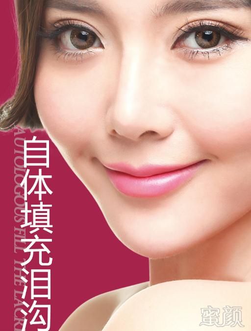 https://img.miyanlife.com/mnt/Editor/2019-12-27/5e05bfc174679.jpg