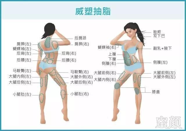 https://img.miyanlife.com/mnt/Editor/2020-03-04/5e5f7c122e31f.jpg