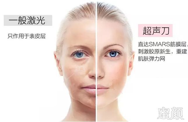 https://img.miyanlife.com/mnt/Editor/2020-03-23/5e786f14e215d.jpg