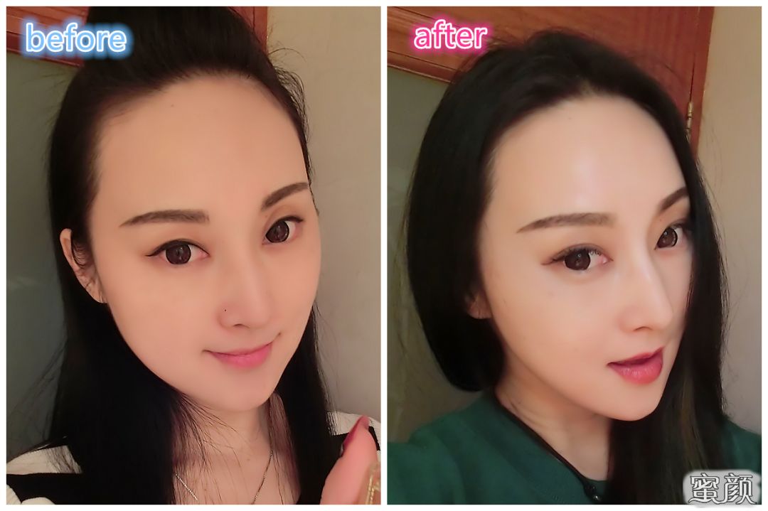 https://img.miyanlife.com/mnt/Editor/2020-04-28/5ea7a96ca3315.jpg