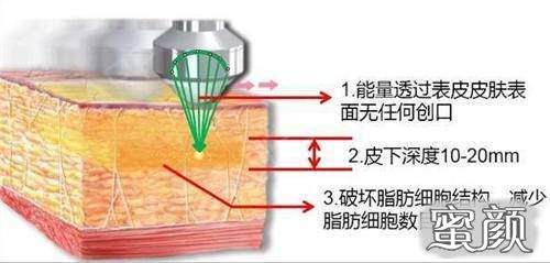 案例图片