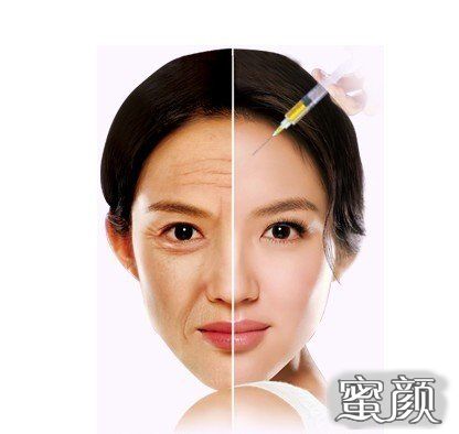 https://img.miyanlife.com/mnt/Editor/2020-05-27/5ece214874682.jpg