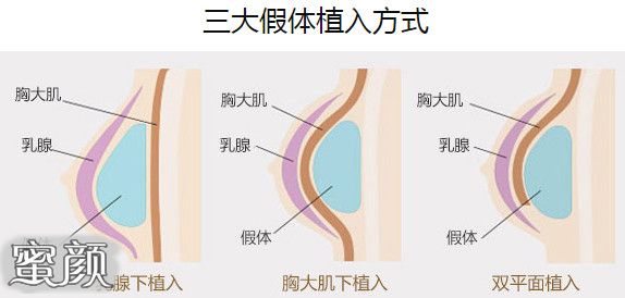 案例图片