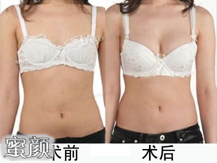 https://img.miyanlife.com/mnt/Editor/2020-06-29/5ef9e76747854.jpg