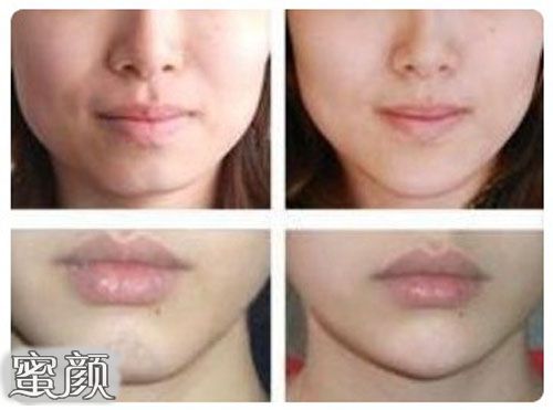 https://img.miyanlife.com/mnt/Editor/2020-07-03/5efeede700525.jpg