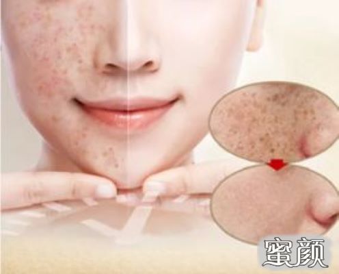 https://img.miyanlife.com/mnt/Editor/2020-07-05/5f017b8cbd032.jpg