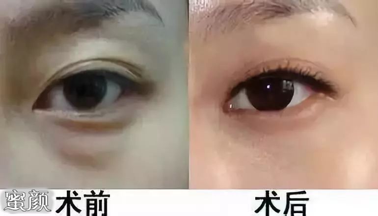 https://img.miyanlife.com/mnt/Editor/2020-07-11/5f0911351b26e.jpg