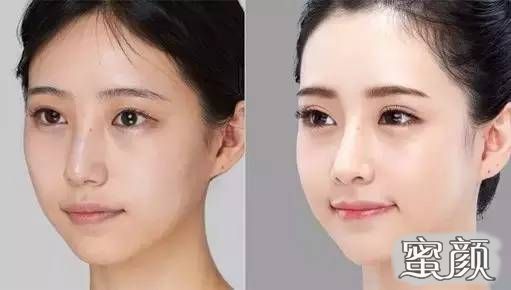 https://img.miyanlife.com/mnt/Editor/2020-07-12/5f0b096ece2ae.jpg