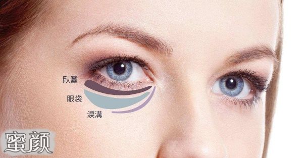 https://img.miyanlife.com/mnt/Editor/2020-07-14/5f0d081748fdc.jpg