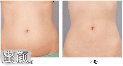 https://img.miyanlife.com/mnt/Editor/2020-07-14/5f0d8bb3cfc94.jpg
