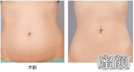 https://img.miyanlife.com/mnt/Editor/2020-07-17/5f11a7a4c1eac.jpg