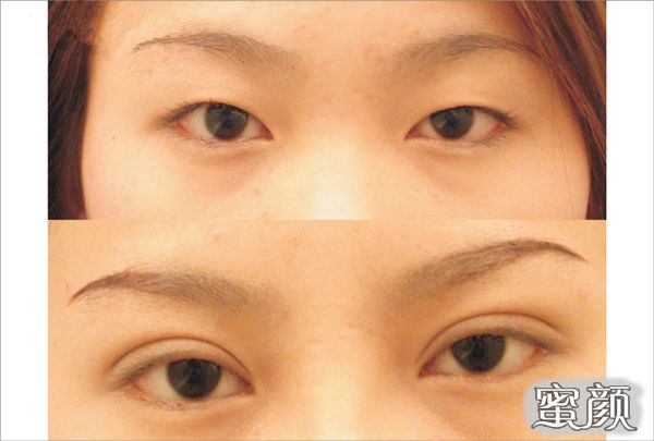 https://img.miyanlife.com/mnt/Editor/2020-07-24/5f1a8d2a98826.jpg
