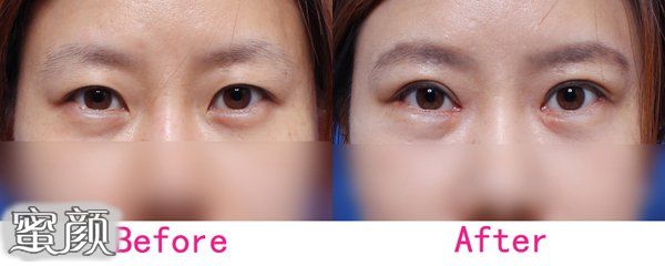 https://img.miyanlife.com/mnt/Editor/2020-07-24/5f1a8d3355000.jpg