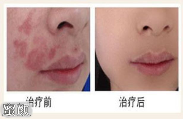 https://img.miyanlife.com/mnt/Editor/2020-07-31/5f23da4d57cdb.jpg