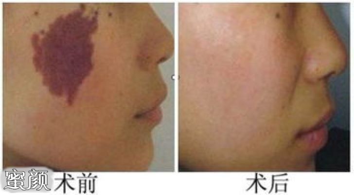 https://img.miyanlife.com/mnt/Editor/2020-07-31/5f23da5b2375e.jpg