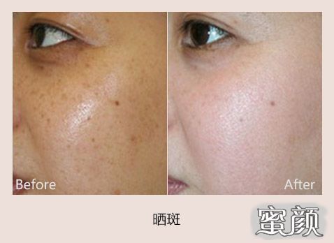 https://img.miyanlife.com/mnt/Editor/2020-08-16/5f3947dc332e9.jpg