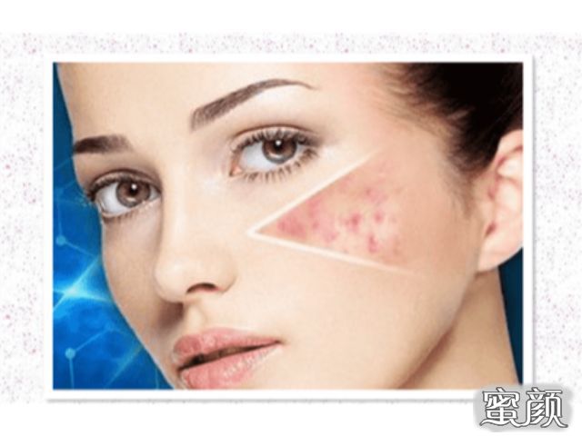 https://img.miyanlife.com/mnt/Editor/2020-08-27/5f47a3a447285.jpg