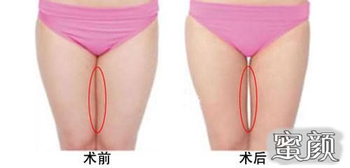https://img.miyanlife.com/mnt/Editor/2020-08-30/5f4ba6ecd77f8.jpg