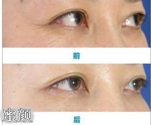 https://img.miyanlife.com/mnt/Editor/2020-09-06/5f54d1e9043ba.jpg