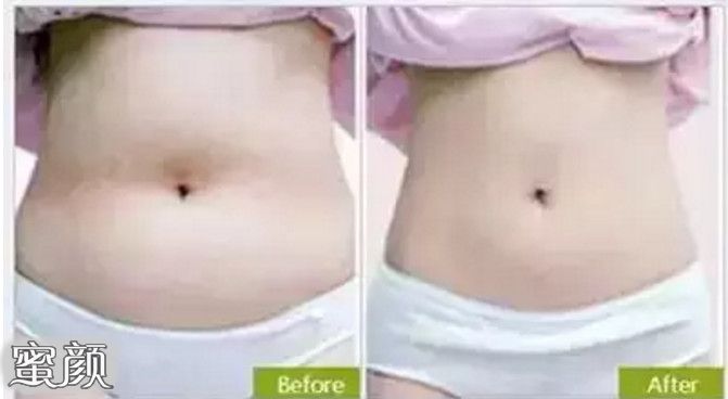 https://img.miyanlife.com/mnt/Editor/2020-09-07/5f55fb3d1faf1.jpg