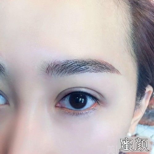 https://img.miyanlife.com/mnt/Editor/2020-09-08/5f5768383fb7c.jpg
