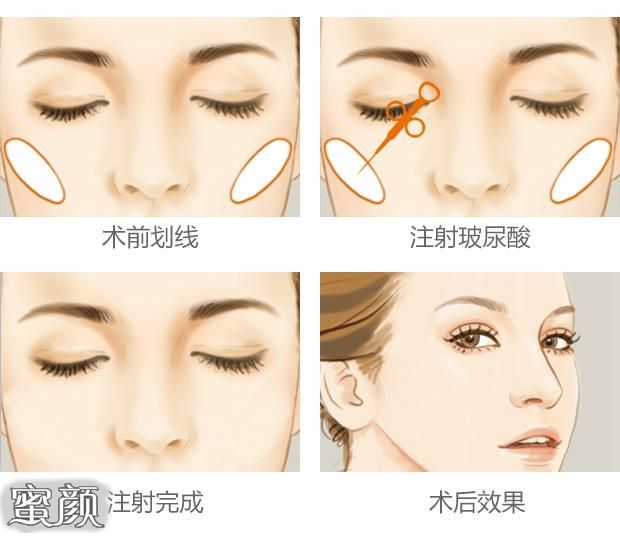 https://img.miyanlife.com/mnt/Editor/2020-09-10/5f5962d3df245.jpg