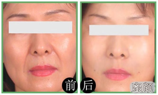 https://img.miyanlife.com/mnt/Editor/2020-09-15/5f60b49096349.jpg