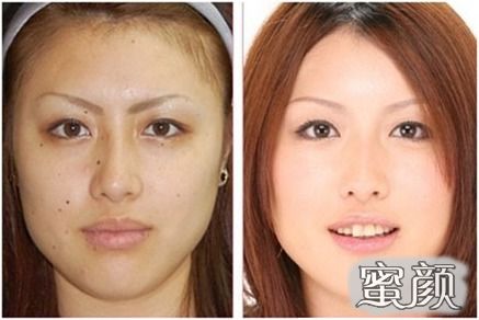 https://img.miyanlife.com/mnt/Editor/2020-09-17/5f637317ed1ae.jpg