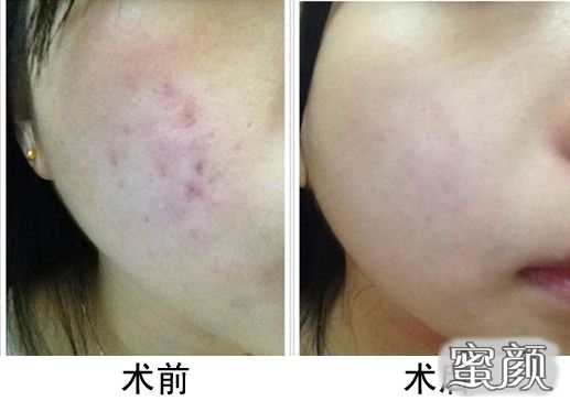 https://img.miyanlife.com/mnt/Editor/2020-09-17/5f63735cd0e7c.jpg
