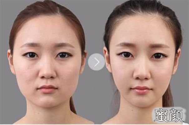 https://img.miyanlife.com/mnt/Editor/2020-09-19/5f65b550c02c2.jpg