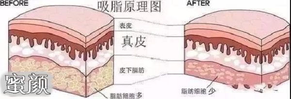 案例图片