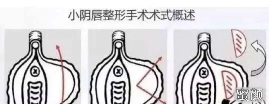 案例图片