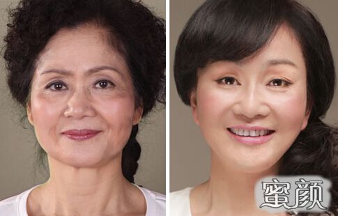 https://img.miyanlife.com/mnt/Editor/2020-09-28/5f71d9127d823.jpg
