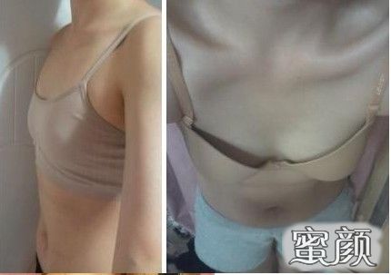https://img.miyanlife.com/mnt/Editor/2020-10-12/5f83ead8c9364.jpg