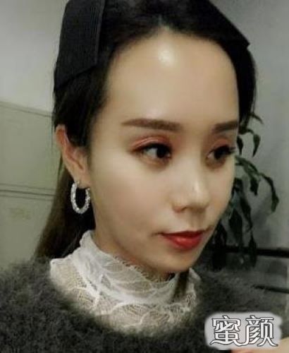 https://img.miyanlife.com/mnt/Editor/2020-10-14/5f86712abb6ad.jpg