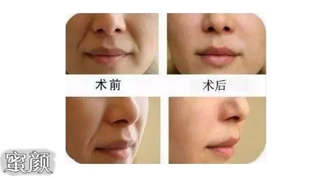 https://img.miyanlife.com/mnt/Editor/2020-10-22/5f915ed998118.jpg