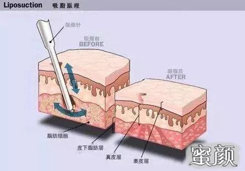 https://img.miyanlife.com/mnt/Editor/2020-10-22/5f915ee6493c5.jpg