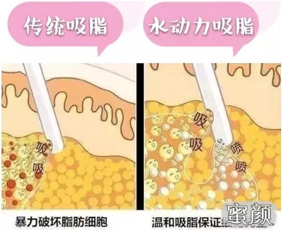 https://img.miyanlife.com/mnt/Editor/2020-10-22/5f915ef695bc7.jpg